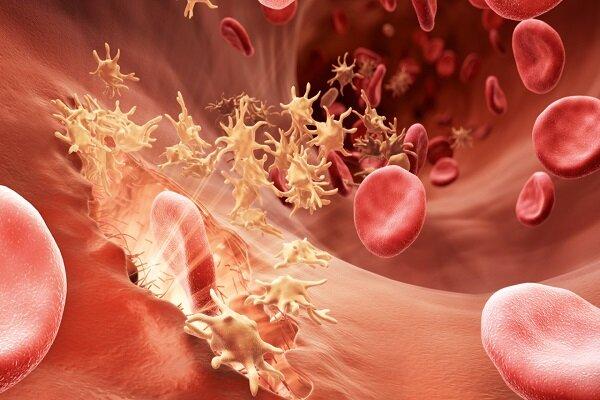 چطور تشخیص دهیم به غلظت خون مبتلا هستیم یا نه؟